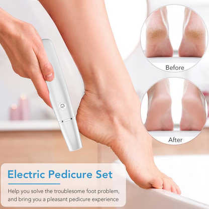 SmoothSole™ Electric Callus Remover